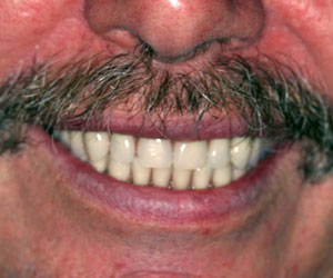 Photographie - Un sourire retrouvé